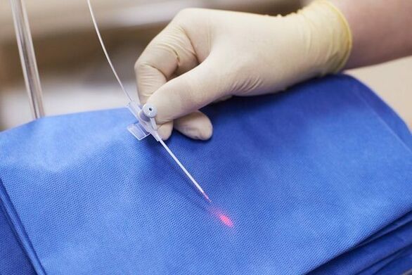 W niektórych przypadkach w przypadku przewlekłego zapalenia gruczołu krokowego stosuje się terapię laserową