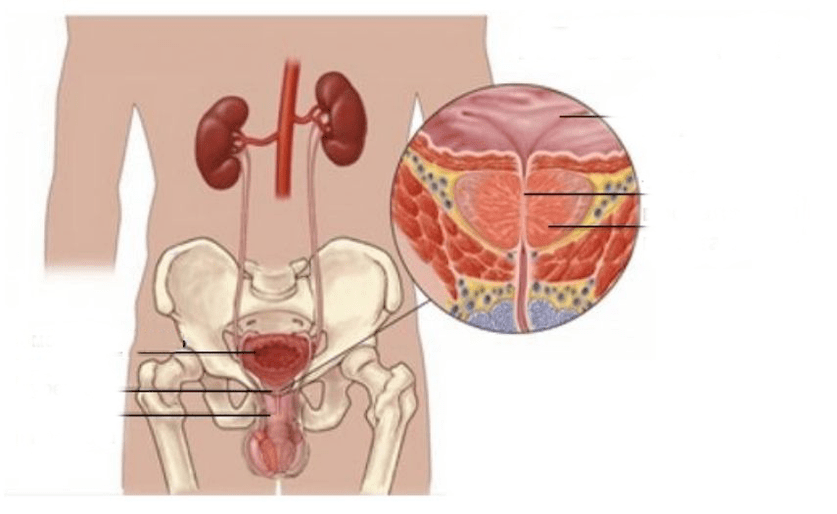 zapalenie prostaty u mężczyzn